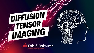 New Technology to Diagnose Traumatic Brain Injuries: Diffusion Tensor Imaging (DTI)