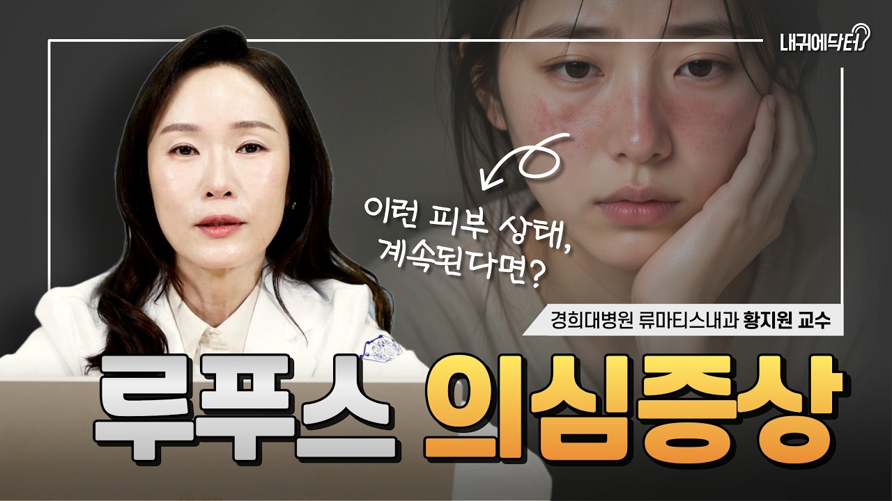 자꾸 피곤하고 얼굴이 붉어진다면? 루푸스 의심!🚨 | 경희대병원 황지원교수