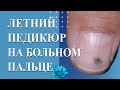 Летний педикюр. Как делать педикюр на короткие ногти.