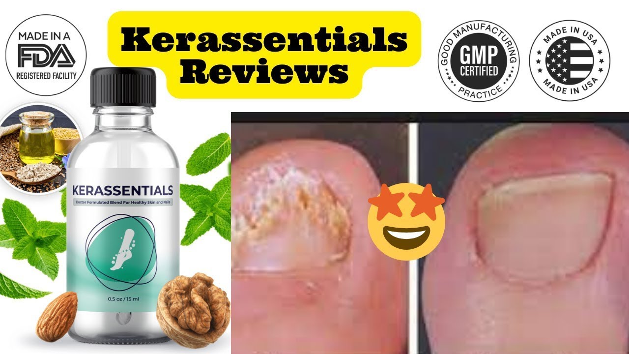 Kerassentials Review – Dr Kimberly’s Fungus  #kerasssentialsreview