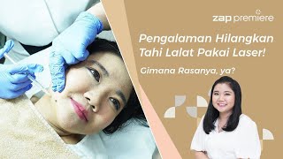 PENGALAMAN HILANGKAN TAHI LALAT PAKAI LASER! GIMANA RASANYA? 😱