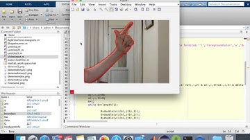 Detection skin region in LiveVideo-Image Processing in Matlab