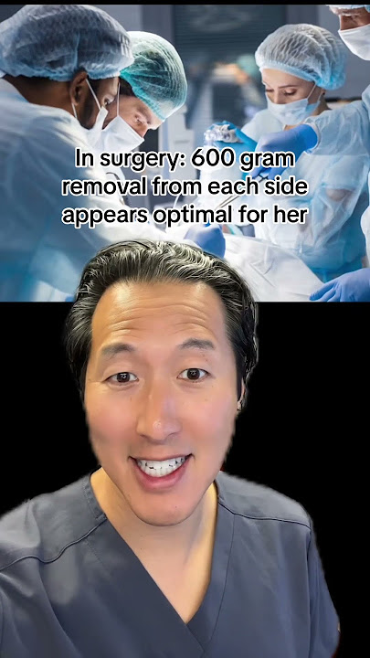 YOU Are The Plastic Surgeon… What Would You Do With This Breast Reduction? #breastreduction