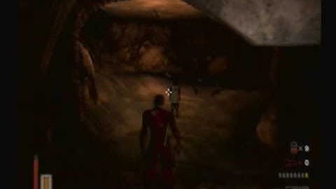 The Suffering Gameplay I Can Sleep When I