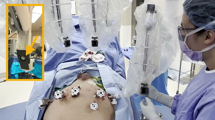 Core Videos (2022): Multi-Port Docking: Da Vinci Xi