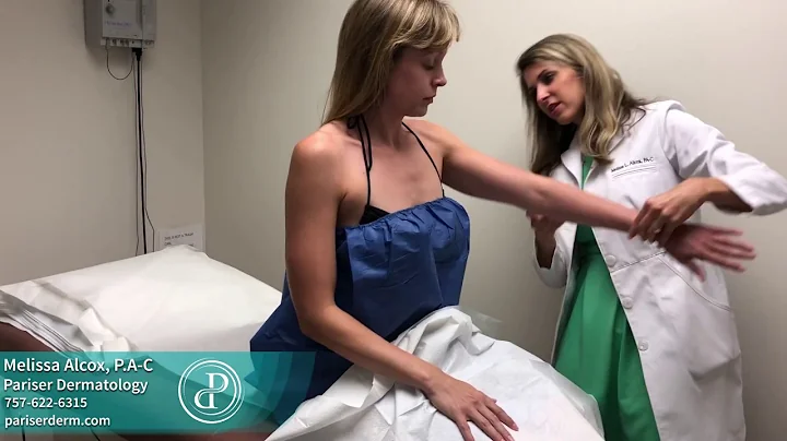 Total Body Skin Exam by PA Melissa Alcox