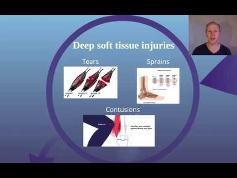 Soft Tissue Injuries