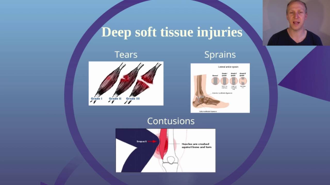 Soft Tissue Injuries 