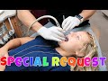 First time getting Braces tightened | Special Request