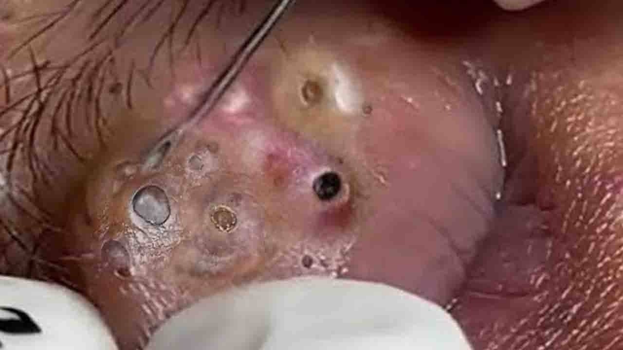 𝑺𝒐𝒐𝒕𝒉𝒊𝒏𝒈 𝑭𝒂𝒄𝒊𝒂𝒍 𝑻𝒓𝒆𝒂𝒕𝒎𝒆𝒏𝒕 𝑭𝒐𝒓 𝑺𝒕𝒓𝒆𝒔𝒔 𝑹𝒆𝒍𝒊𝒆𝒇 𝒂𝒕 𝑳𝒖𝒙𝒖𝒓𝒚 𝑺𝒑𝒂 𝑨𝒄𝒉𝒊𝒆𝒗𝒆 𝑰𝒏𝒏𝒆𝒓 𝑷𝒆𝒂𝒄𝒆 #500825