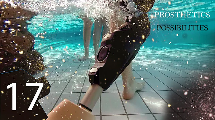 Prosthetics possibilities 17 | Prosthetic leg | Prosthetic arm | Cyborgs World