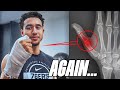 I Got Injured Again... (Hand Injury Update)