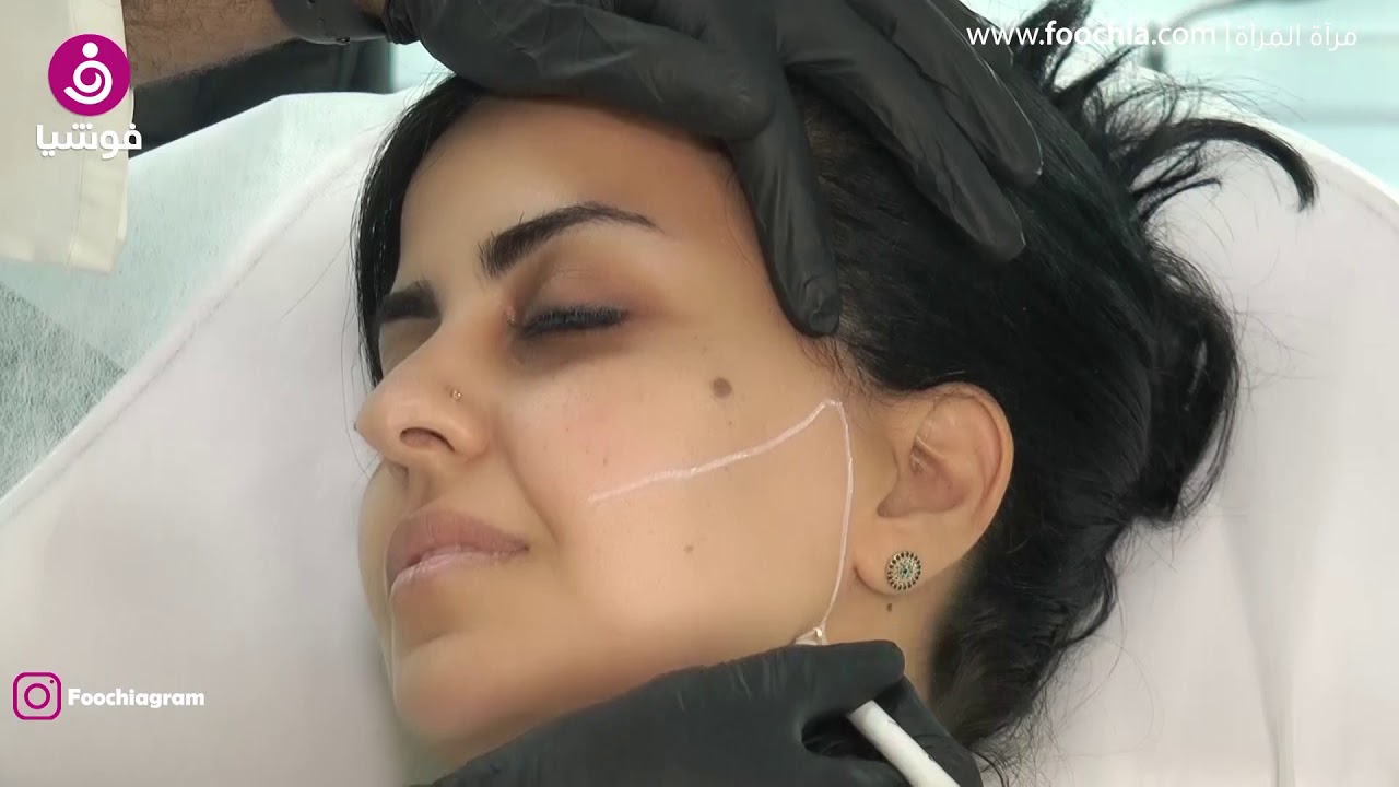 إليك أحدث تقنية لشد الوجه من دون عمليات جراحية