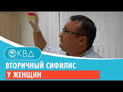 Вторичный сифилис у женщин. Клинический случай №35