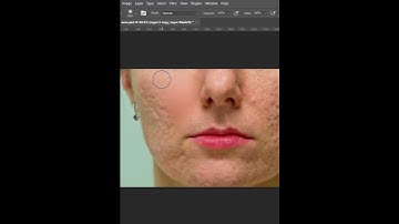 How To Fix Acne Scars or Wrinkles Fast  #shorts #tutorial #photoshop #newtoyou