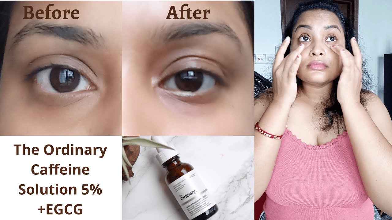 How To Instantly Reduce Under Eye Puffiness The Ordinary Caffeine