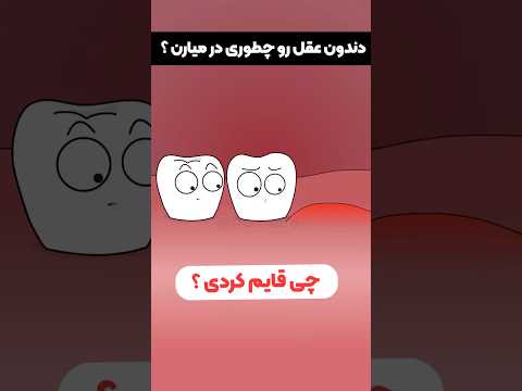 دندون عقل و چطوری در میارن 