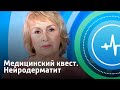 Нейродерматит. Медицинский квест | Телеканал «Доктор»