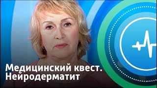 Нейродерматит. Медицинский квест | Телеканал «Доктор»