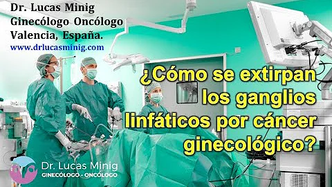 ¿Cuáles son los riesgos de extirpar ganglios linfáticos cancerosos?