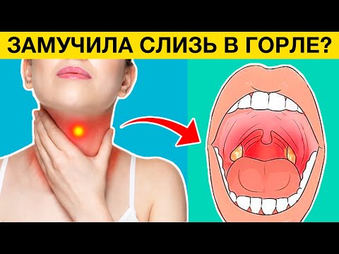 СЛИЗЬ В ГОРЛЕ как избавиться? После этого метода СЛИЗЬ сразу вылетит пулей из легких и горла