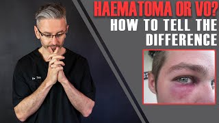 Haematoma Or Vascular Occlusion? How To Tell The Difference... [Aesthetics Mastery Show]