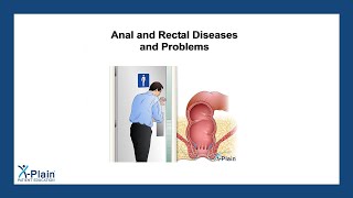 Anal and Rectal Diseases and Problems