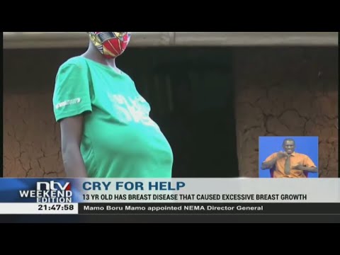 13-year-old girl's breasts swollen, family appeals for help