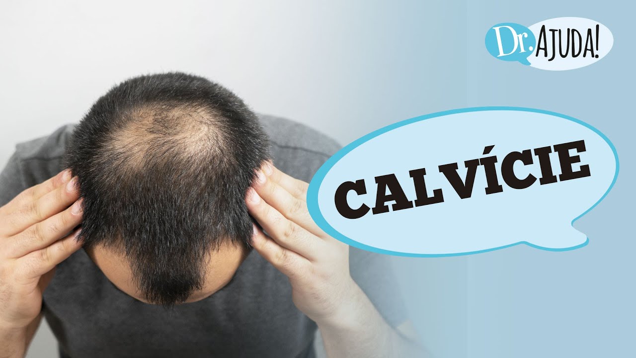 5 PRINCIPAIS INFORMAÇÕES  SOBRE QUEDA DE CABELO