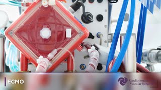 Ecmo Cardiothoracic And Vascular Surgeons Ctvs Texas