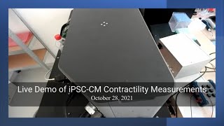 iPSC-derived Cardiomyocyte Contractility Acquisition and Analysis