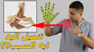 السبب الخفي وراء تنميل اليدين وعلاجه/علاج تنميل اليد والخدران/علاد تنميل اليدين بدون جراحه