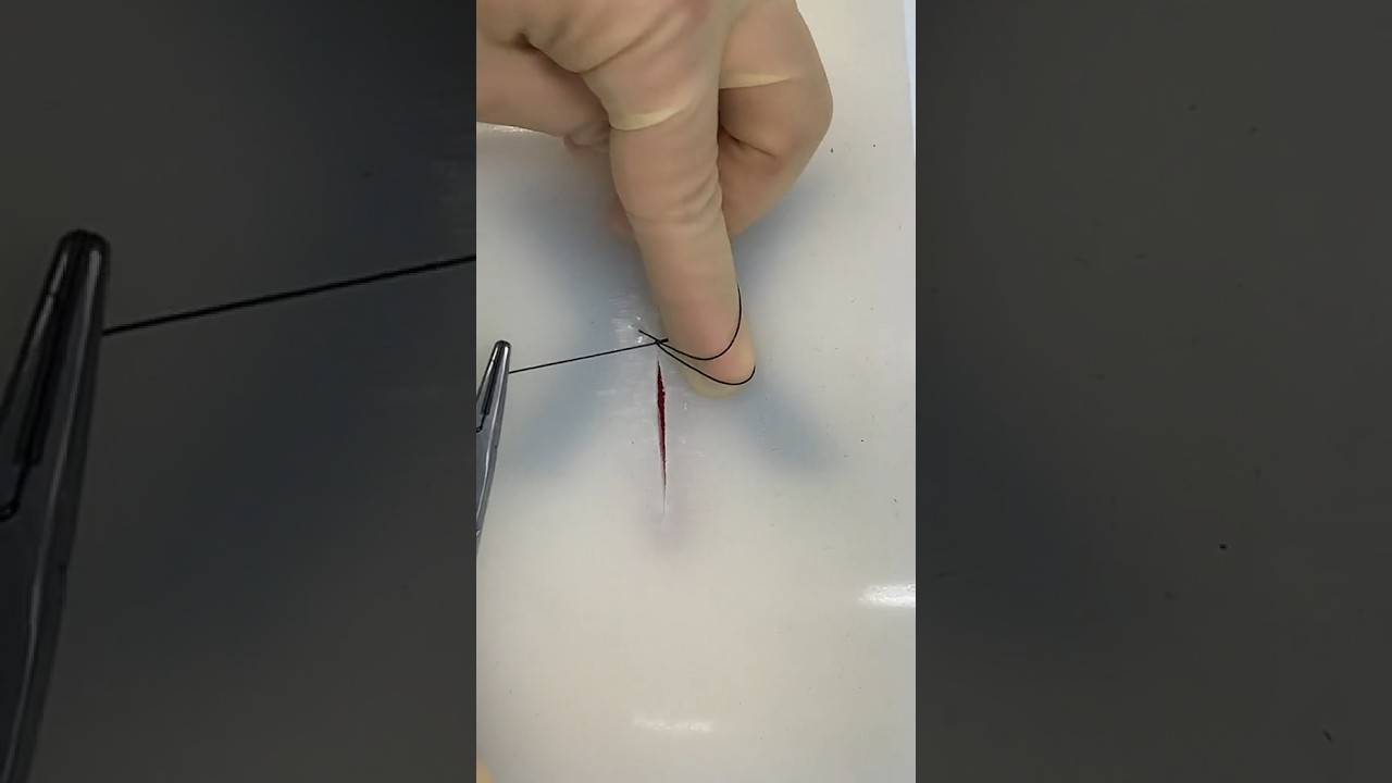 Техника безопасного петлевого шва 