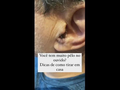 Vídeo: 3 maneiras simples de usar um aparador de nariz