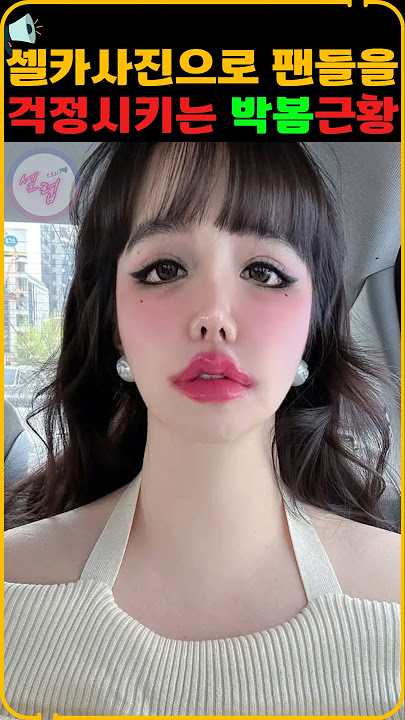 셀카사진으로 팬들을 걱정시키는 박봄