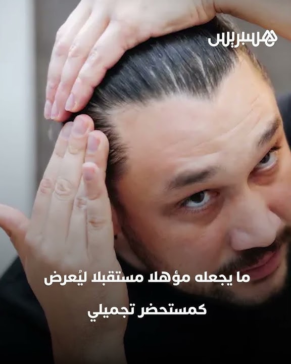 ابتكار مصل طبي من تايوان يُعيد إنبات الشعر خلال 20 يوما ويفتح الأمل لعلاج طبيعي للصلع