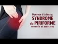 Douleur  la fesse et syndrome du piriforme  exercices et conseils