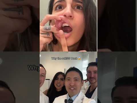 Wideo: Czy płyn do płukania ust pomoże w owrzodzeniu jamy ustnej?