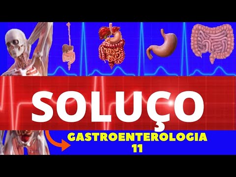 Vídeo: Soluços Crônicos: Causas, Tratamentos E Muito Mais