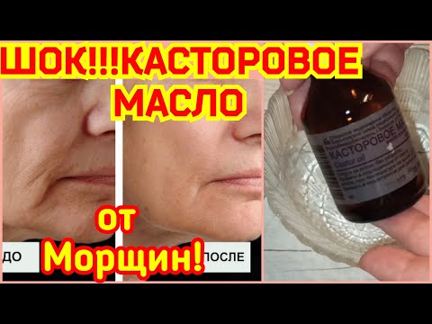Дешёвое Касторовое масло Омолодит Лучше дорогой косметики! 2 ЛУЧШИХ РЕЦЕПТА КРАСОТЫ ✅