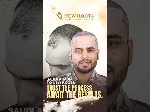 From Saudi Arabia to Bangladesh | Hair Transplant Cost in Bangladesh | Bangla #hair #shorts