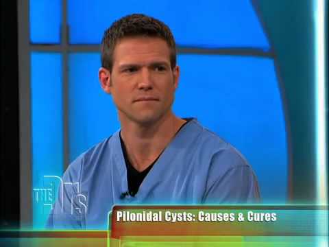 pilonidal-surgery-causes-and-cures-lilapdoc