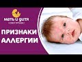 🥛  Диагностика аллергии на белок коровьего молока у детей. Аллергия на белок коровьего молока. 12+