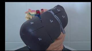 :    