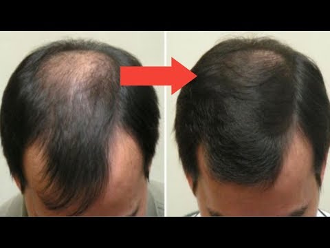 Video: Kako Ojačati Kosu: 10 Savjeta I Samostalnih Tretmana