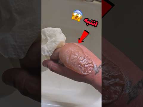 لا تقم بثقب هذه الفقاعة ابدا و السبب سيصدمك