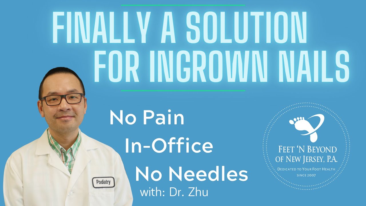 Topical Solution for Ingrown Nails! YouTube