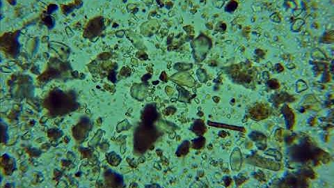 Soil Health: Microscopy Test (Massaro Farm - Carbon Proxy Test location)