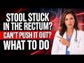 Stool Stuck and Won’t Come Out? Doctor Explains What It Means