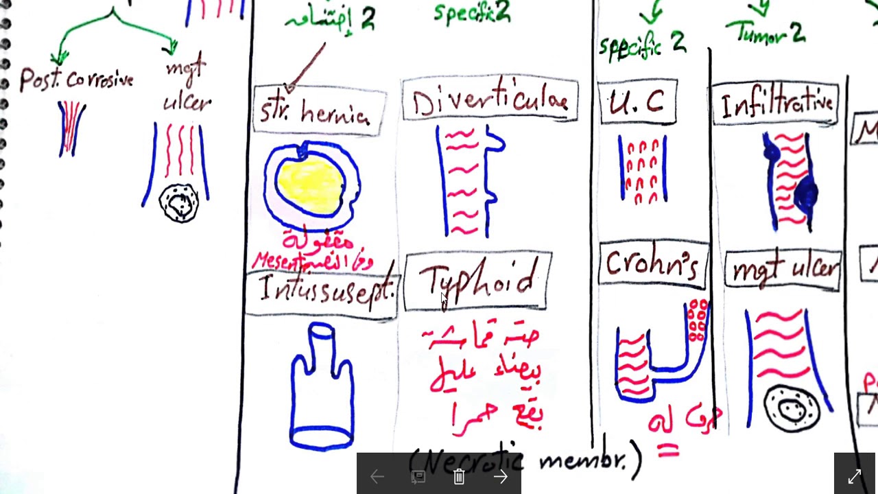 Oral Pathology 1 5 By Iug Video Lectures